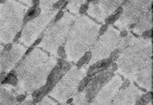 Electron micrograph of a longitudinal section of sarcomeres